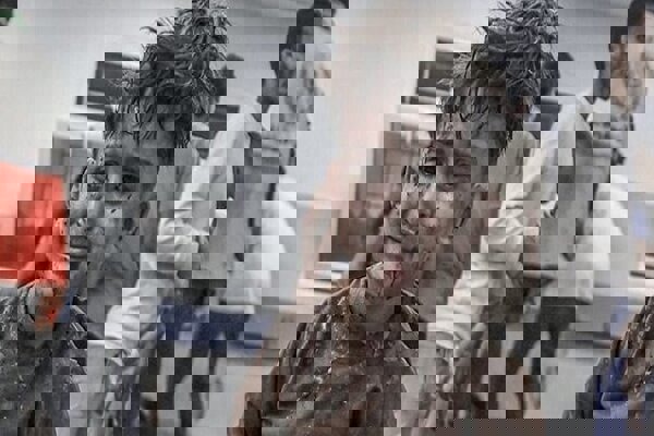 «حکم مرگ تدریجی» ۲۰۰ هزار مجروح غزه چگونه امضا می‌شود